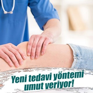 Dizdeki kireçlenmeye kök hücre yöntemi
