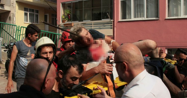 Görenler şoke oldu! Hastaneye böyle getirildi