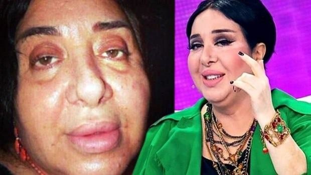 Ünlüleri bir de makyajsız görün