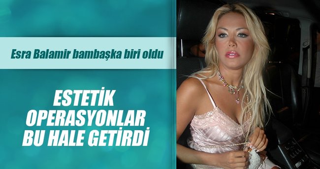 Iste Esra Balamir In Son Hali Sanal Basin