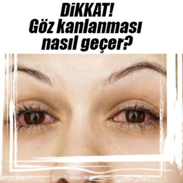 Goz Kanlanmasi Nasil Gecer Sanal Basin