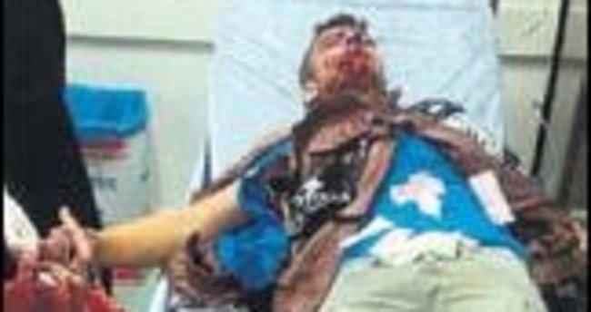 Polise atarken elinde patladı