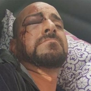 Belçika'da ırkçılar Türk vatandaşını Erdoğancı diye darp etti